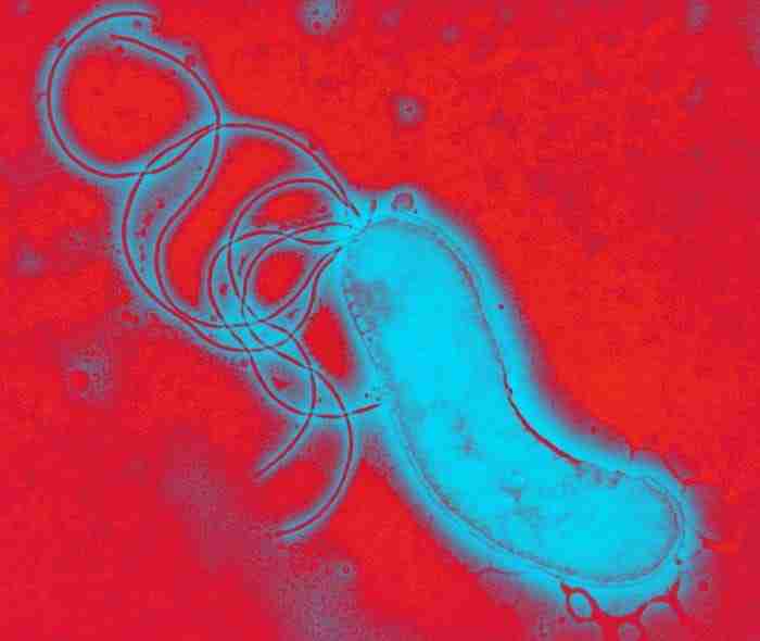 helicobacter pylori e1622389833684