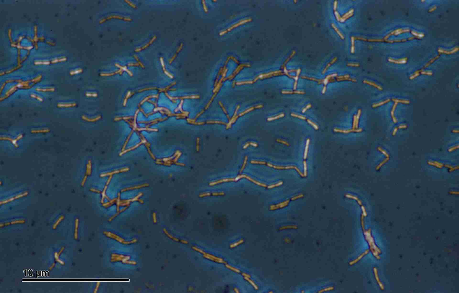 Lactobacillus acidophilus 259 09 Lactobacillus acidophilus Döderlein bacillus scaled
