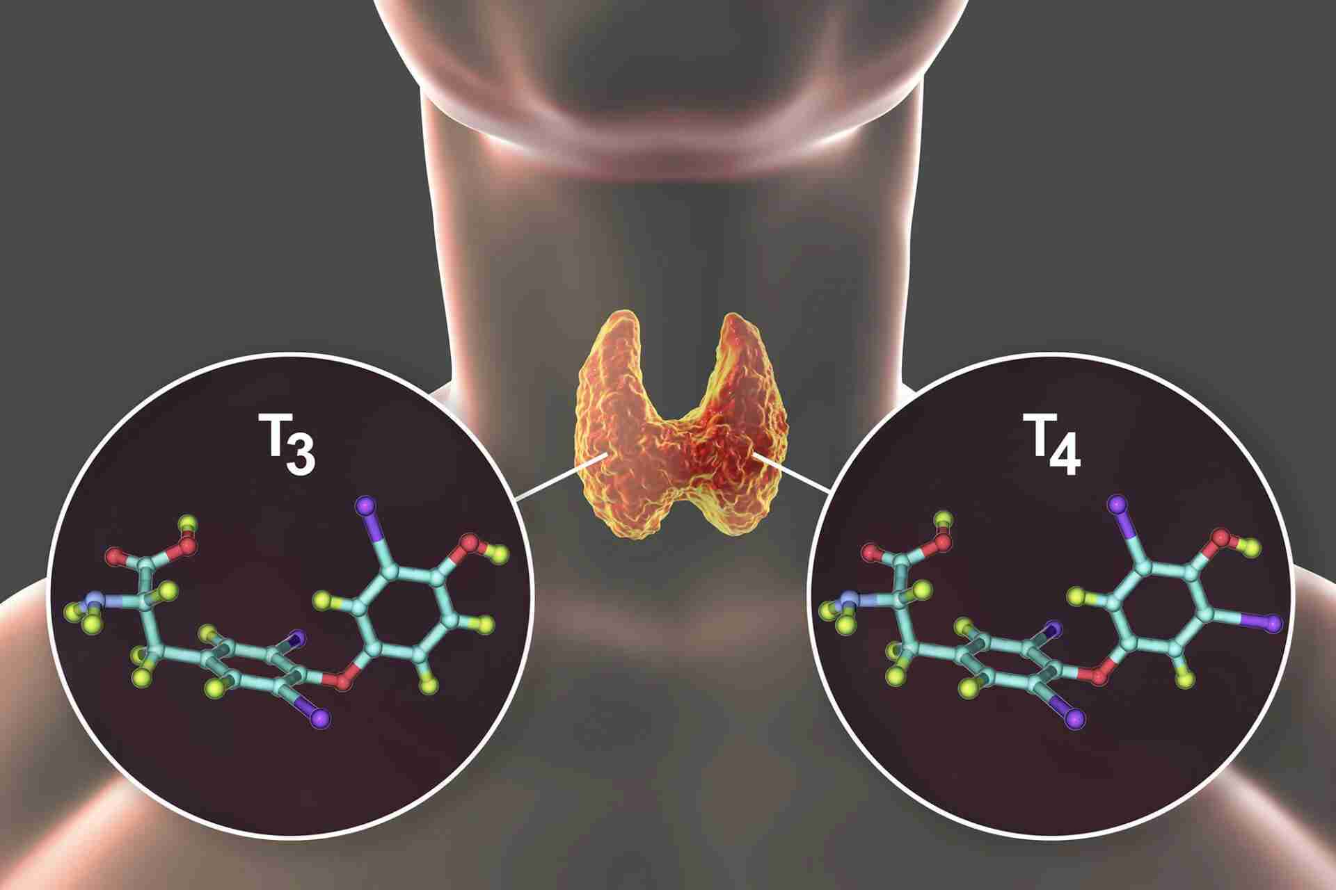 triiodotironina