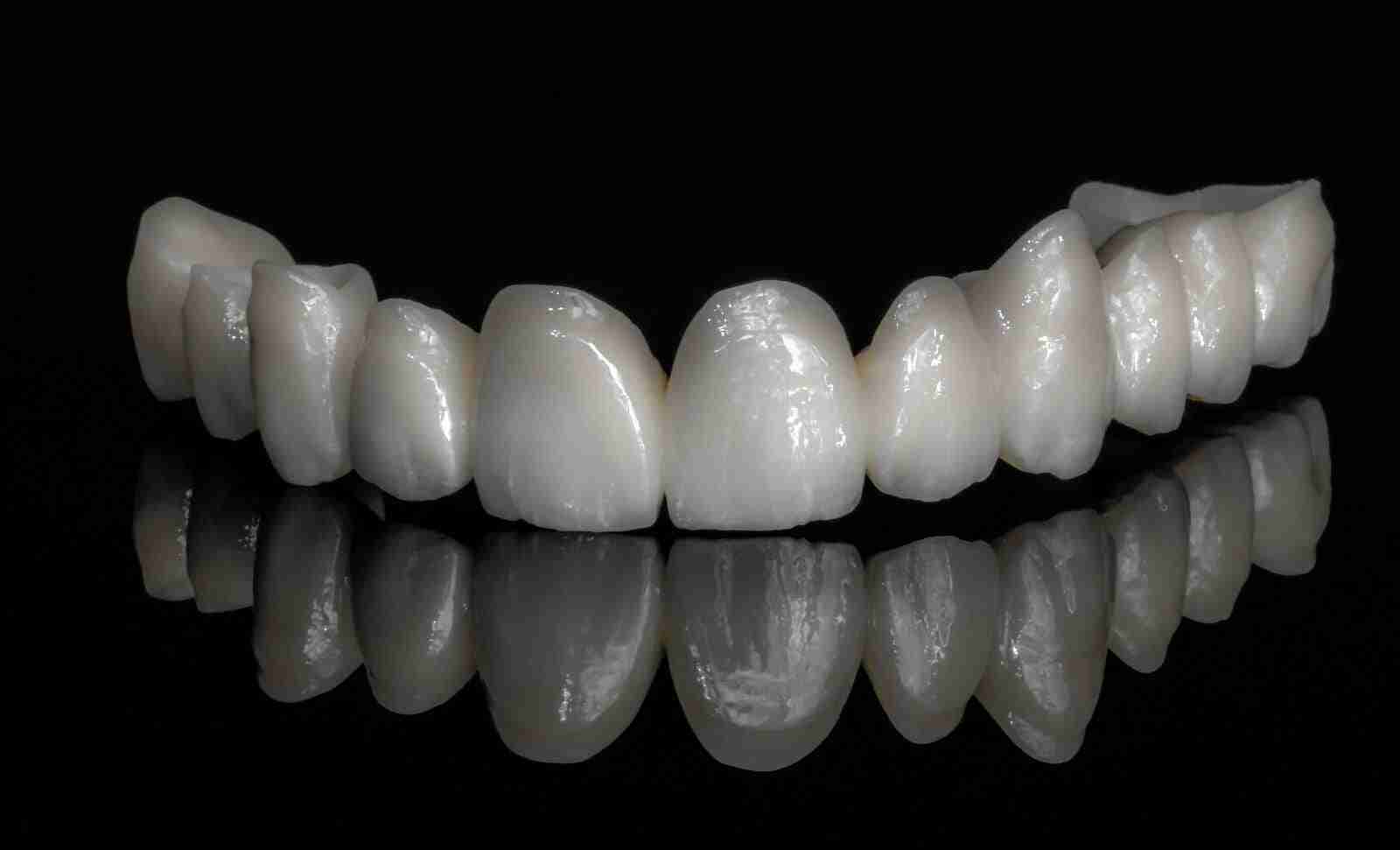 ceramiche dentali