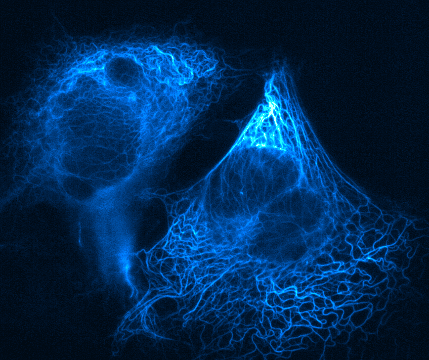 Ciclopentanoperidrofenantrene