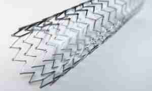 stent stent