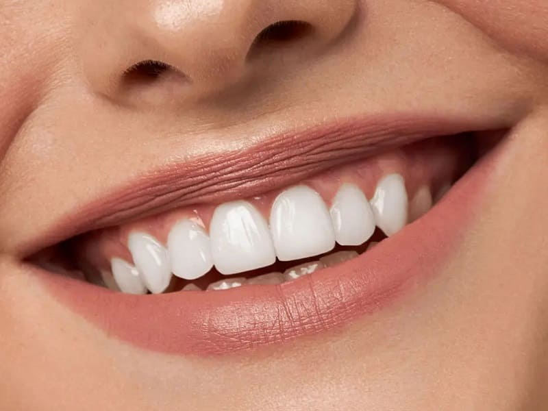 impianti-dentali