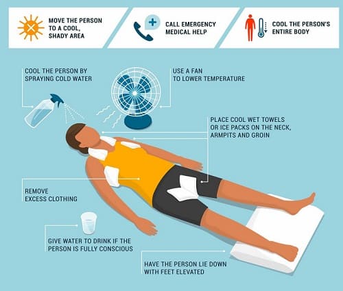 trattamenti del colpo di calore