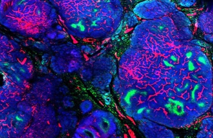 immunotossine